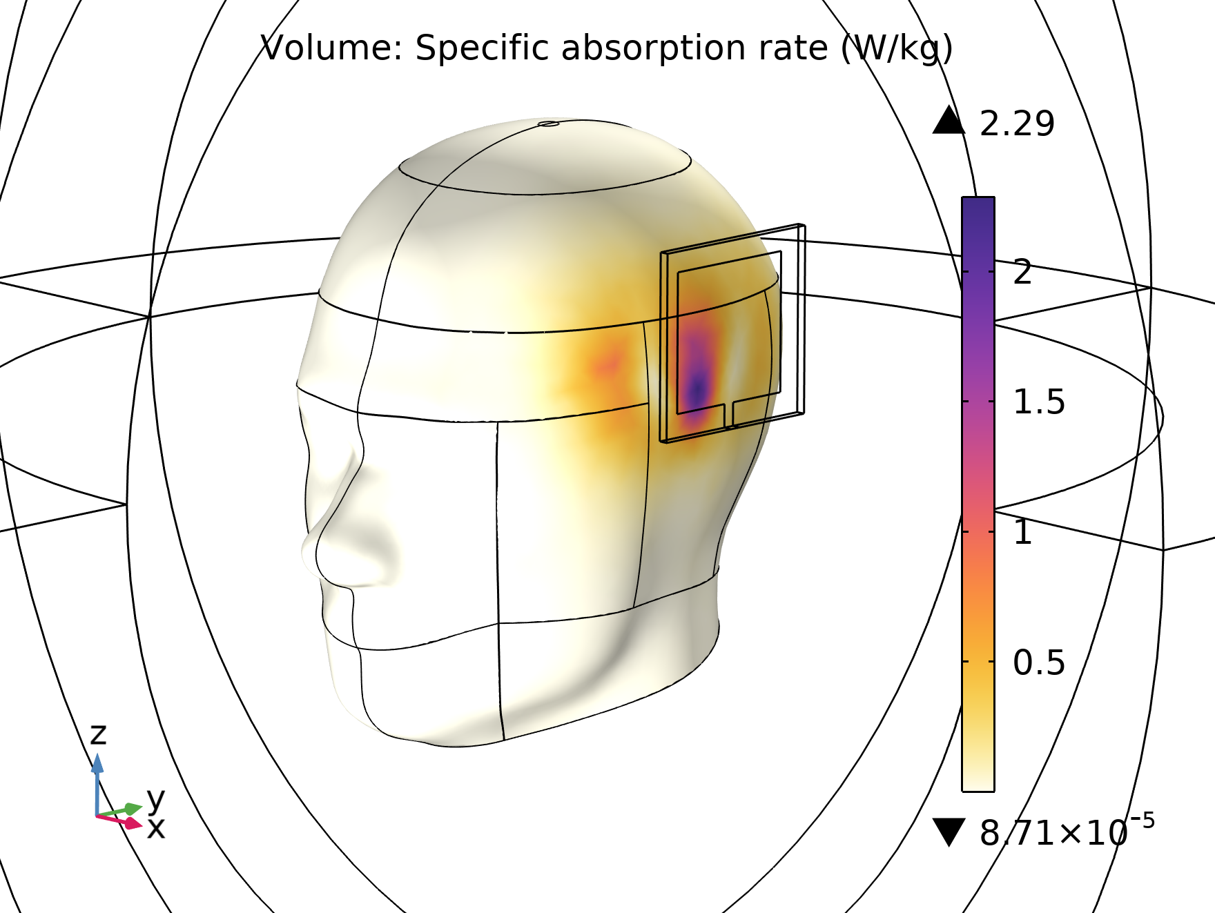 Tasa de absorción del modelo Specific absorption rate sar in the human brain [2].